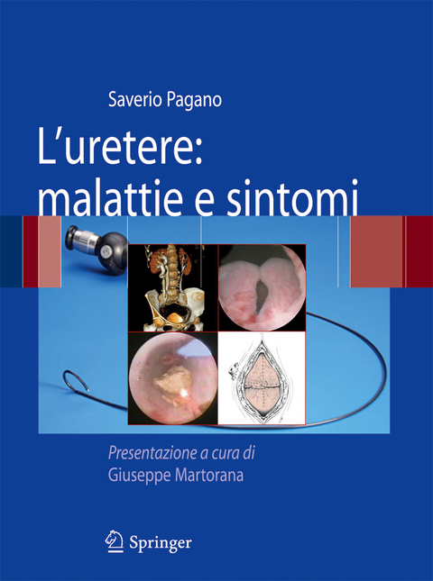 L'uretere: malattie e sintomi - Saverio Pagano