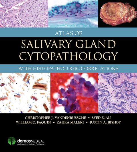 Atlas of Salivary Gland Cytopathology - Christopher J. VandenBussche, Syed Z. Ali, William C. Faquin, Zahra Maleki, Justin Bishop