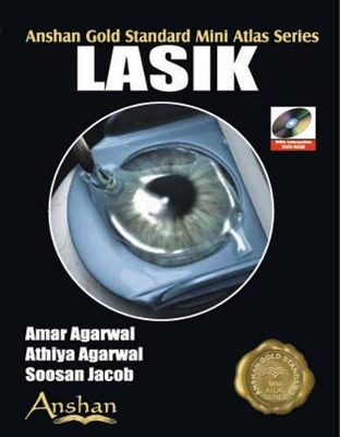 Mini Atlas of Lasik - 