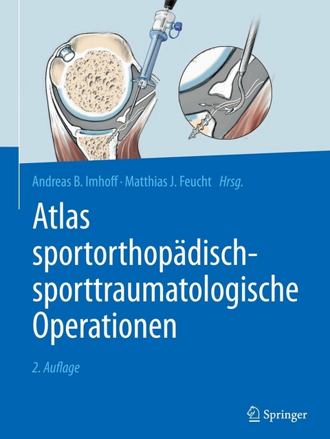 Atlas sportorthopädisch-sporttraumatologische Operationen - 