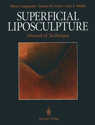 Superficial Liposculpture -  Marco Gasparotti,  Carson M. Lewis,  Luiz S. Toledo