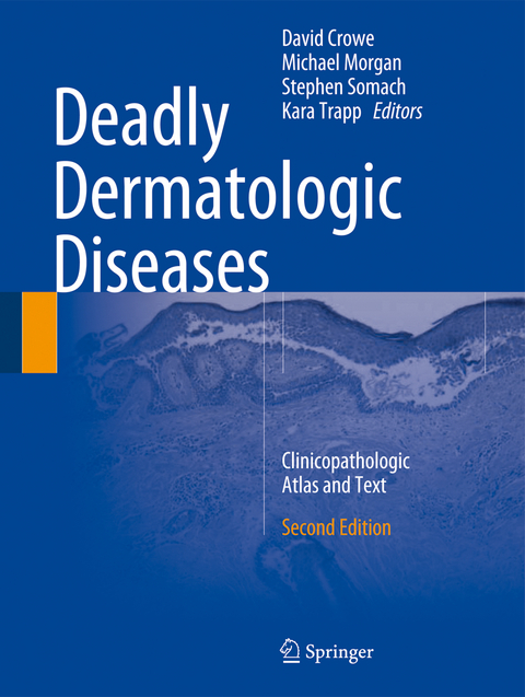 Deadly Dermatologic Diseases - 