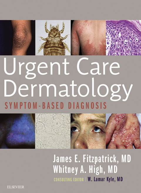 Urgent Care Dermatology: Symptom-Based Diagnosis E-Book -  James E. Fitzpatrick,  Whitney A. High