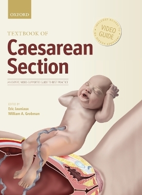 Textbook of Caesarean Section - 