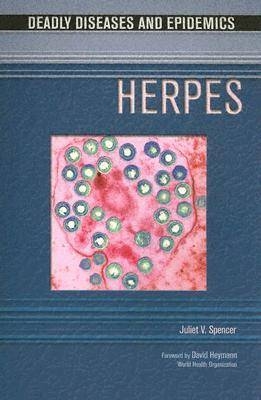 Herpes - Juliet V. Spencer