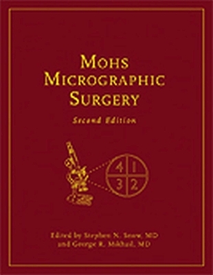 Mohs Micrographic Surgery - 