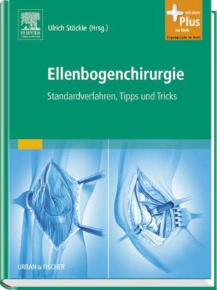 Ellenbogenchirurgie - 