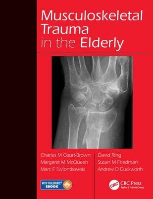 Musculoskeletal Trauma in the Elderly - 