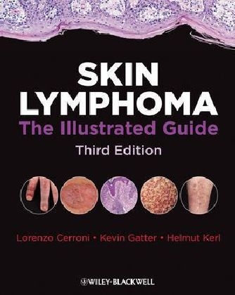 Skin Lymphoma - Lorenzo Cerroni, Kevin Gatter, Kerl Helmut