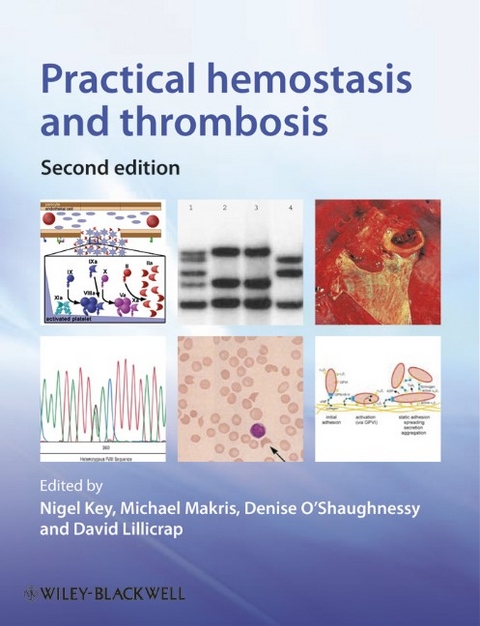 Practical Hemostasis and Thrombosis - 