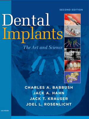 Dental Implants - Charles A. Babbush, Jack A. Hahn, Jack T. Krauser, Joel L. Rosenlicht