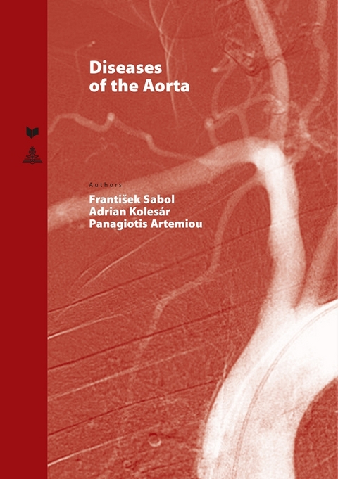 Diseases of the Aorta - 