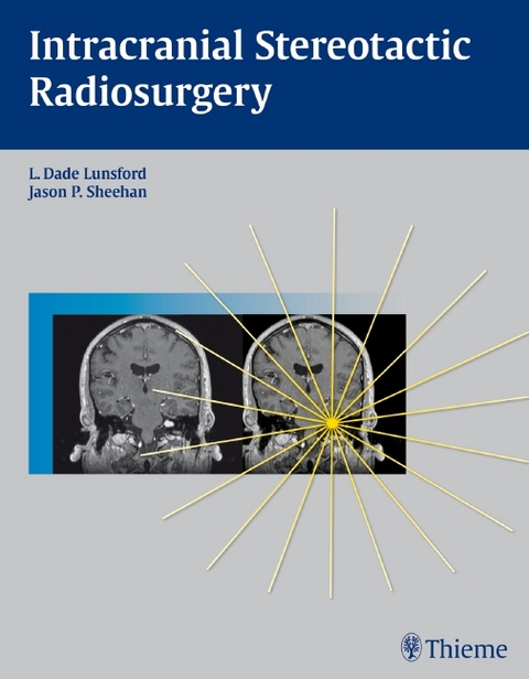 Intracranial Stereotactic Radiosurgery - 