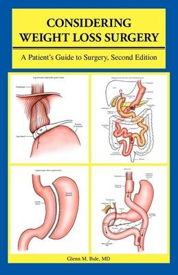 Considering Weight Loss Surgery - Glenn M. Ihde