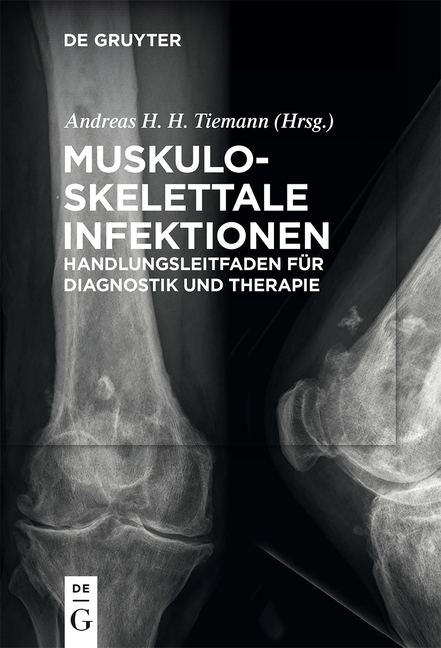 Muskuloskelettale Infektionen - 