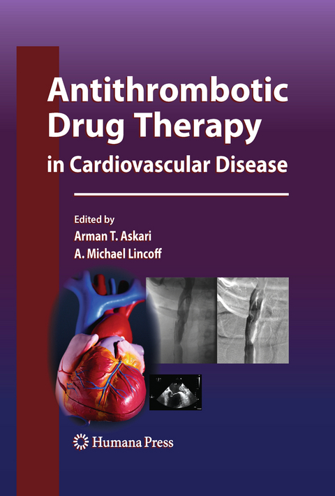 Antithrombotic Drug Therapy in Cardiovascular Disease - 