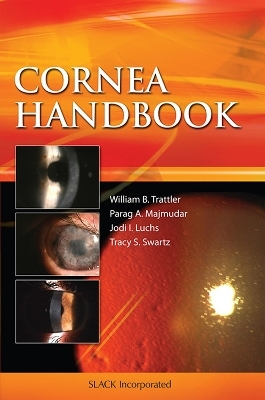 Cornea Handbook - William B. Trattler, Parag A. Majmudar, Jodi I. Luchs, Tracy Swartz