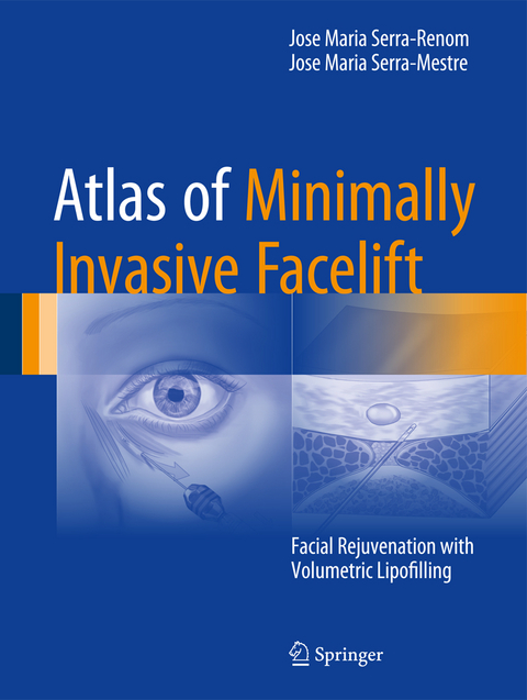 Atlas of Minimally Invasive Facelift - Jose Maria Serra-Renom, Jose Maria Serra-Mestre