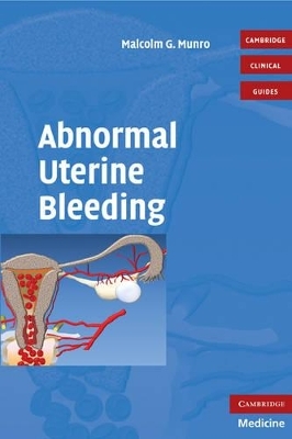 Abnormal Uterine Bleeding with DVD - Malcolm G. Munro