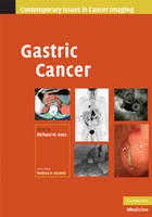 Gastric Cancer - 