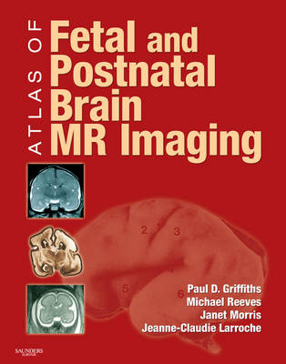 Atlas of Fetal and Postnatal Brain MR - Paul D. Griffiths, Janet Morris, Jeanne-Claudie Larroche, Michael Reeves