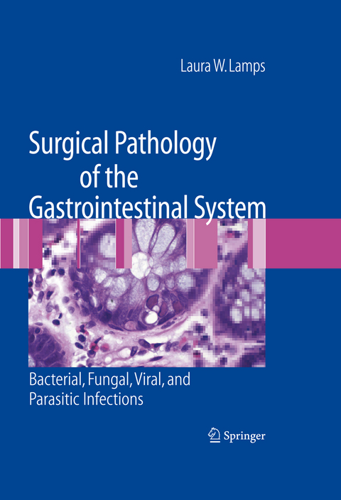 Surgical Pathology of the Gastrointestinal System: Bacterial, Fungal, Viral, and Parasitic Infections - Laura W. Lamps