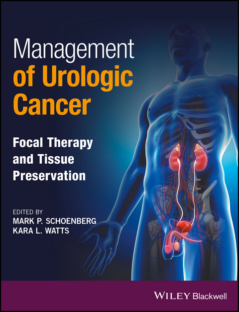 Management of Urologic Cancer - 