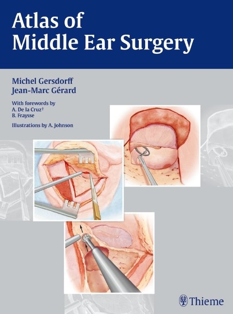 Atlas of Middle Ear Surgery - Michel Gersdorff, Jean-Marc Gérard