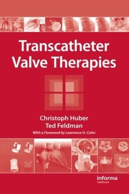 Transcatheter Valve Therapies - Christoph Huber, Ted Feldman