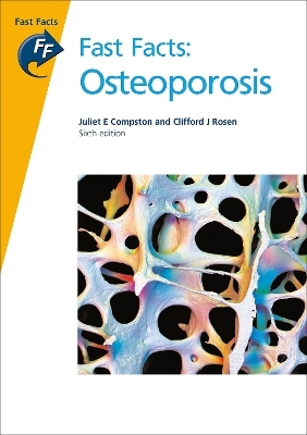 Fast Facts: Osteoporosis - Juliet E Compston, Clifford J Rosen