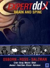 EXPERTddx : Brain and Spine - Anne G. Osborn, Jeff Ross, Julia Crim, Karen L. Salzman