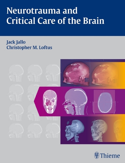 Neurotrauma and Critical Care of the Brain - 