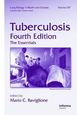 Tuberculosis - 