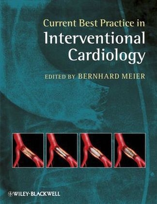 Current Best Practice in Interventional Cardiology - 