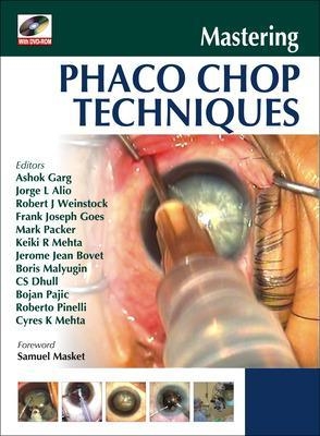 Mastering Phaco Chop Techniques - Ashok Garg