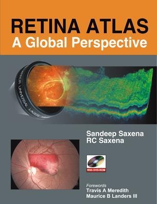 Retina Atlas: A Global Perspective - Sandeep Saxena, R.C. Saxena