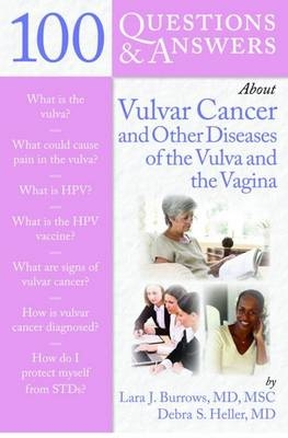 100 Questions  &  Answers About Vulvar Cancer And Other Diseases Of The Vulva And Vagina - Debra S Heller, Lara J Burrows