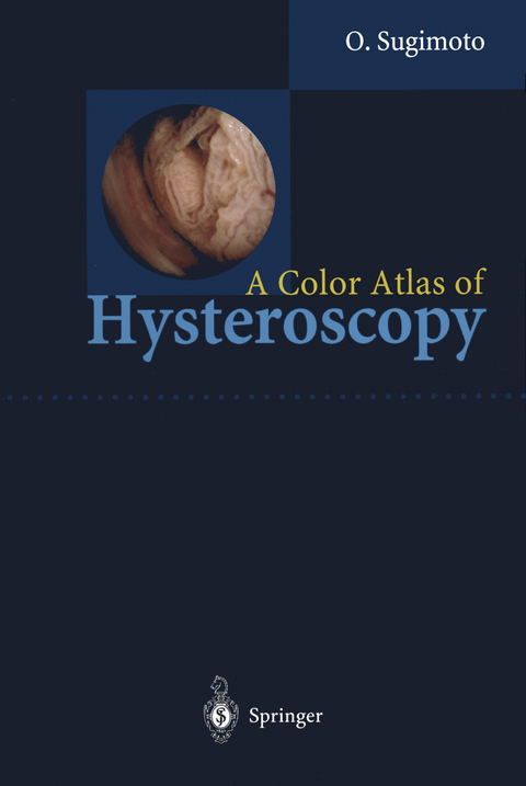 A Color Atlas of Hysteroscopy - Osamu Sugimoto