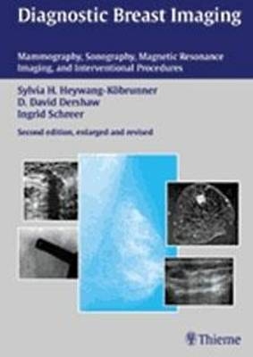 Diagnostic Breast Imaging - Sylvia H. Heywang-Köbrunner, D. David Dershaw, Ingrid Schreer