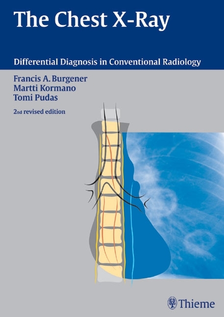 The Chest X-Ray - Francis A. Burgener, Martti Kormano, Tomi Pudas