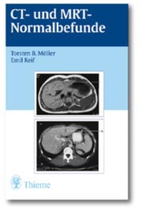 CT und MRT Normalbefunde - Torsten Bert Möller, Emil Reif