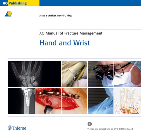 AO Manual of Fracture Management - Hand and Wrist - Jesse Jupiter, David Ring