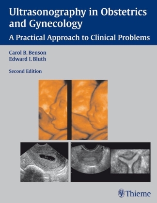 Ultrasonography in Obstetrics and Gynecology - Edward I. Bluth Carol B. Benson