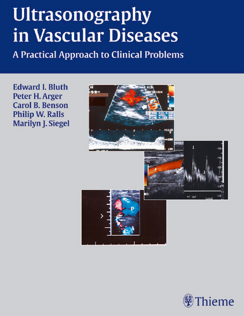 Ultrasonography in Vascular Diseases - 