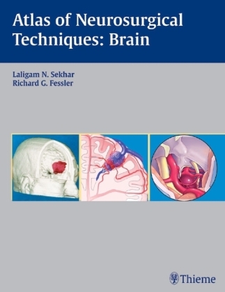 Atlas of Neurosurgical Techniques - Laligam N. Sekhar, Richard G. Fessler