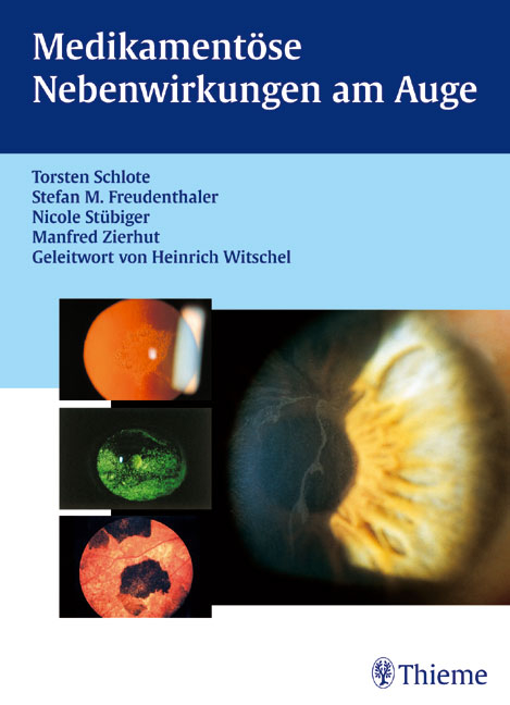 Medikamentöse Nebenwirkungen am Auge - Torsten Schlote, Stefan M Freudenthaler, Nicole Stübiger