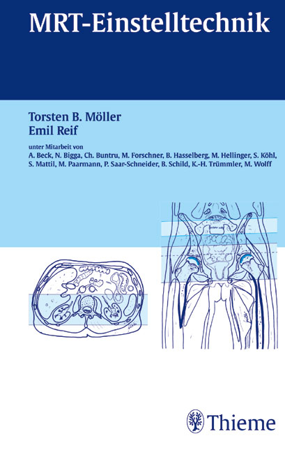 MRT-Einstelltechnik - Torsten B Möller, Emil Reif, Andrea Beck, Nicole Bigga, Christoph Buntru