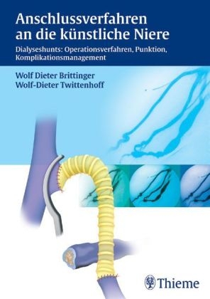 Anschlussverfahren an die künstliche Niere - Wolf D Brittinger, Wolf D Twittenhoff