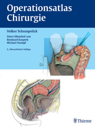 Operationsatlas Chirurgie - Volker Schumpelick