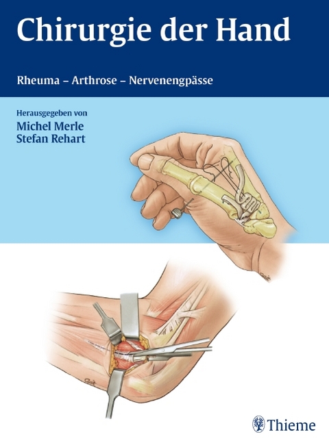 Chirurgie der Hand - Rheuma - Arthrose - Nervenengpässe - Michel Merle